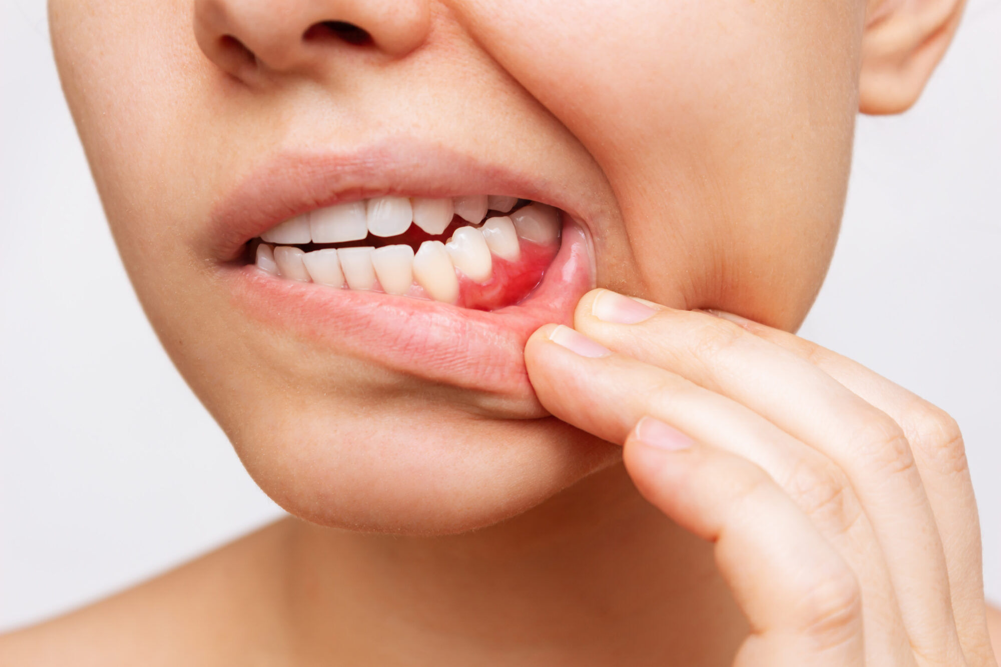 Gum Disease: A Silent Threat to Your Smile – What Hubli & Dharwad Patients Must Know